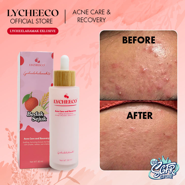 Lycheeco Bedak Sejuk Acne Care & Recovery
